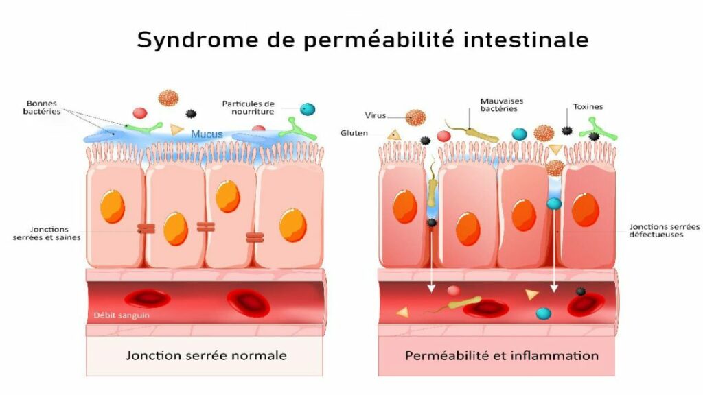 Permeabilite intestinale 1200x675